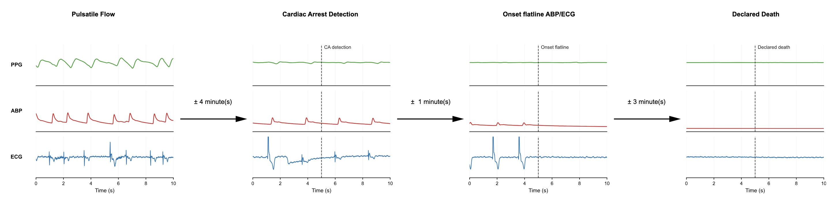 Four panels showing the physiological signals at different stages: normal pulsatile flow, cardiac arrest detection, flatline, and declared death. Each panel displays the smartwatch PPG signal, arterial blood pressure, and ECG.